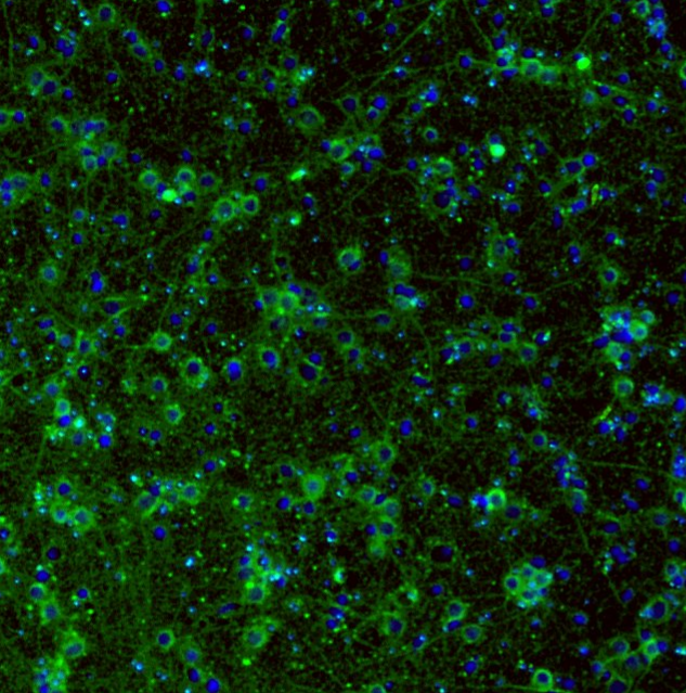 An example fluorescence image of cultured neurons